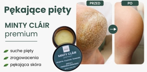 GREEN MOON® MINTY CLÁIR premium – maść pielęgnacyjna do skóry problematycznej i z niedoskonałościami