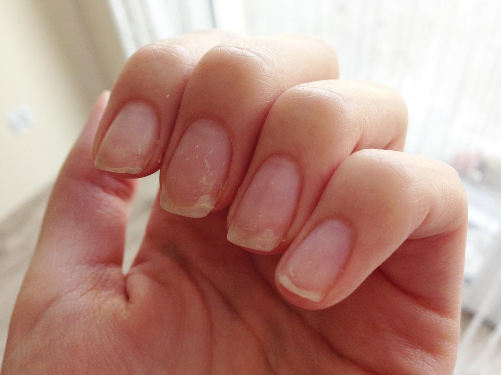 Paznokcie po hybrydach – jak je zregenerować i kiedy zrobić przerwę? 💅