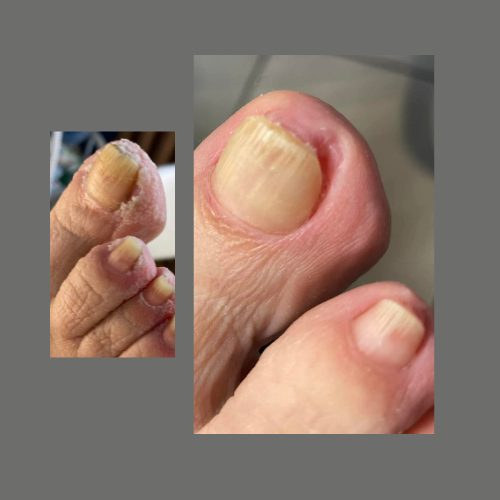 patrycja-jaros-green-moon-kosmetyki-grzybica